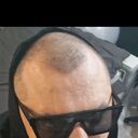 ���������� ��������, ���� ������� �������, 35 ���, ������������ ��� ������, ����� � ���������