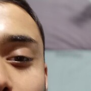 ,   Daler, 31 ,   ,   