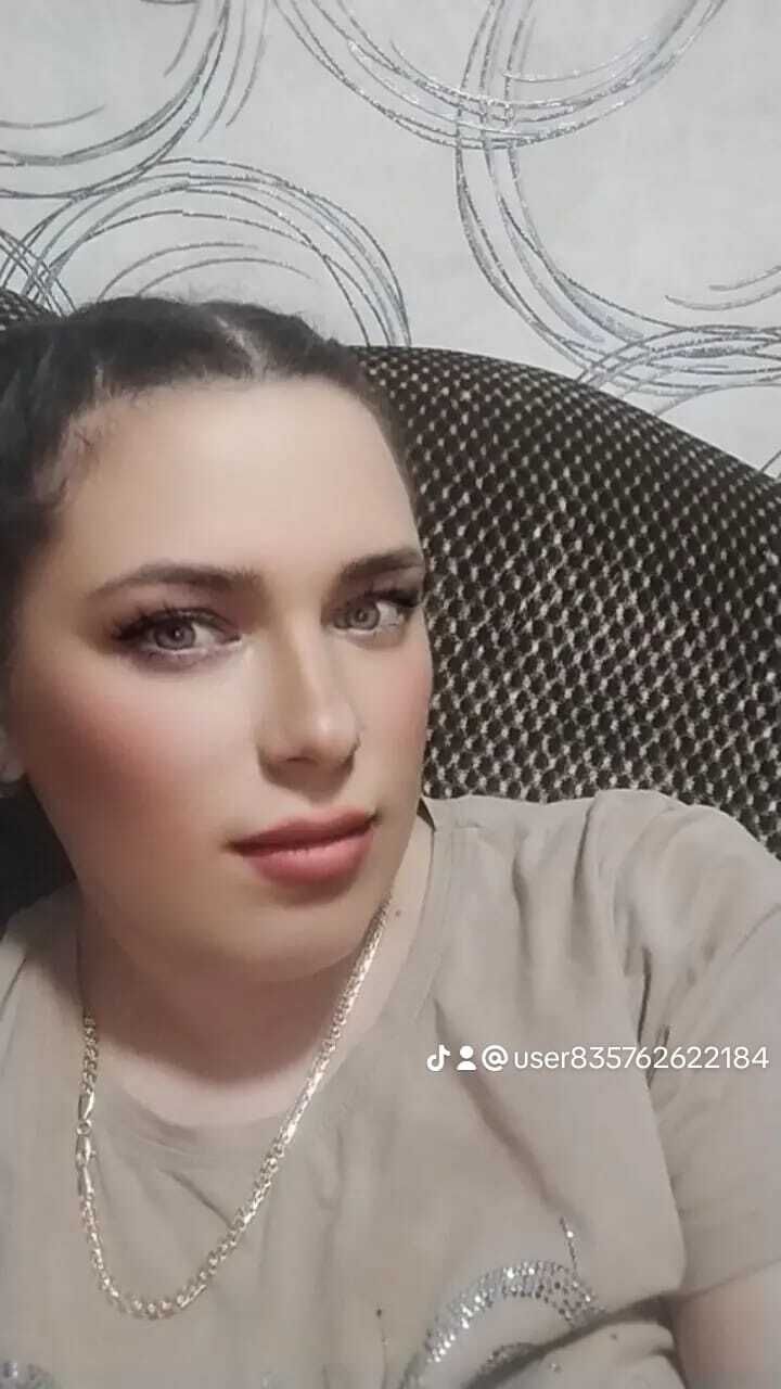  49945676  , 36 ,    