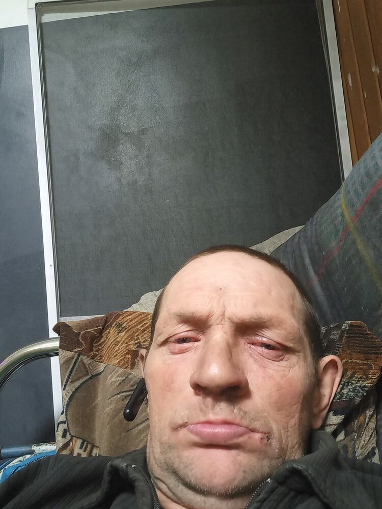  39982926  , 43 ,    