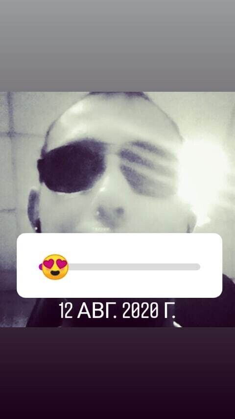  20831406  , 35 ,    