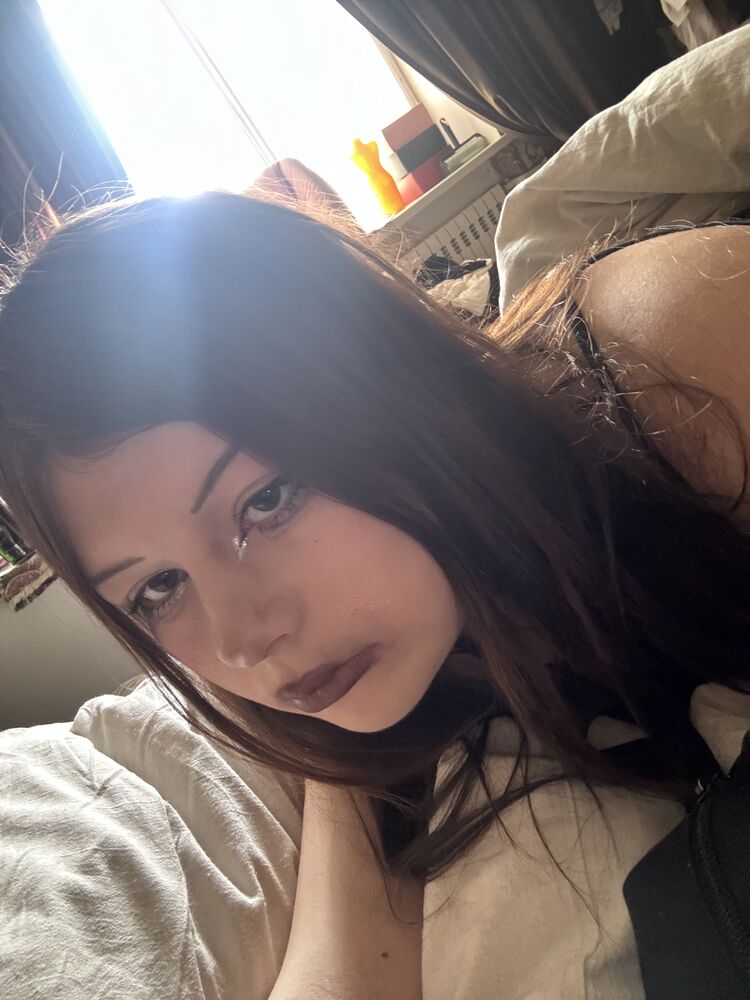  51077006  , 18 ,    