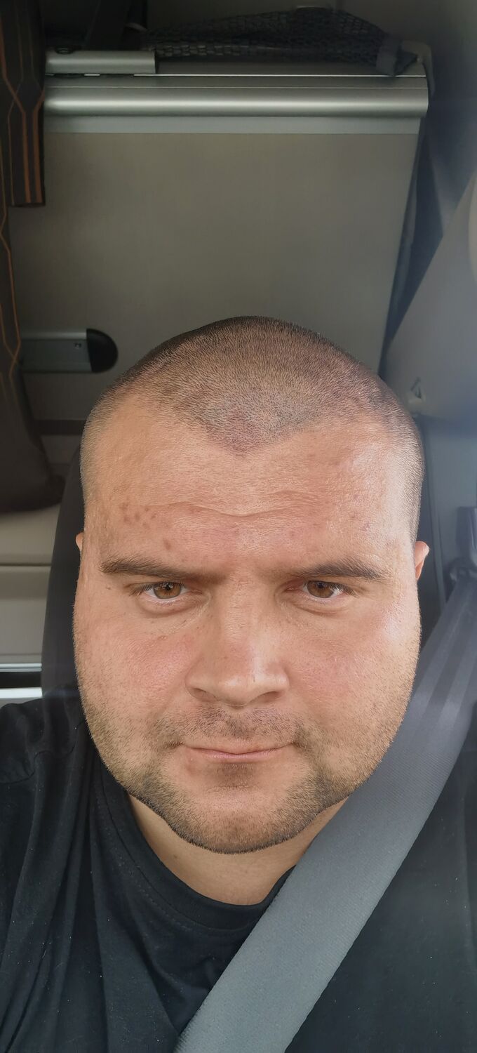  36473976  , 34 ,    