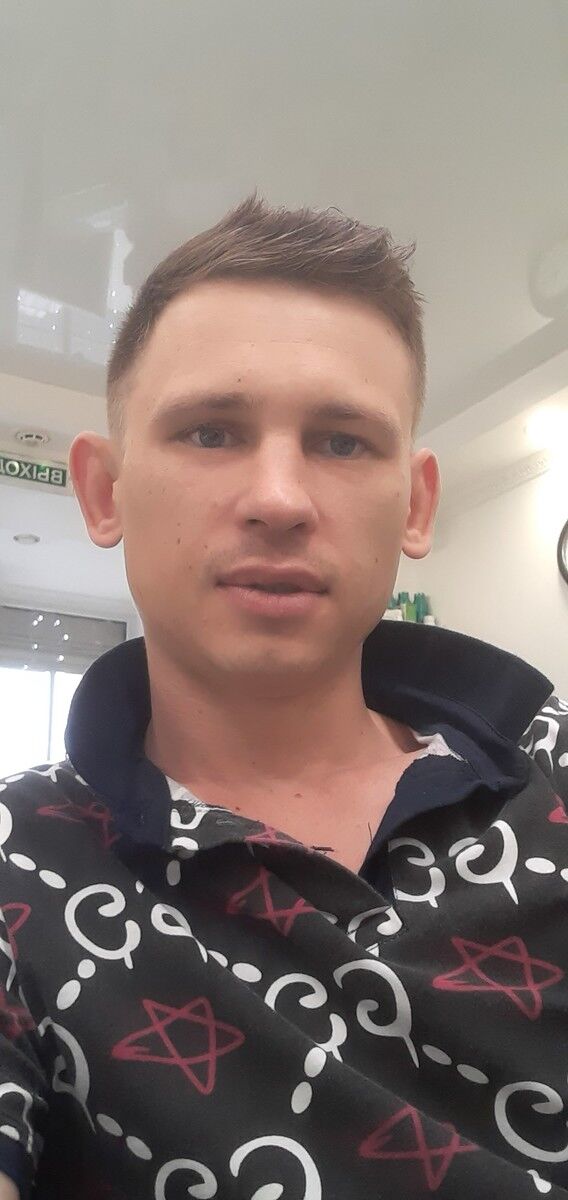  17915576  , 35 ,    --