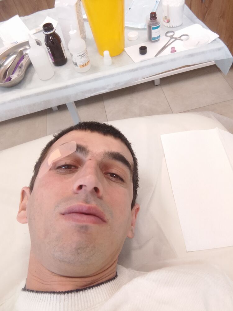 41238646  , 35 ,    