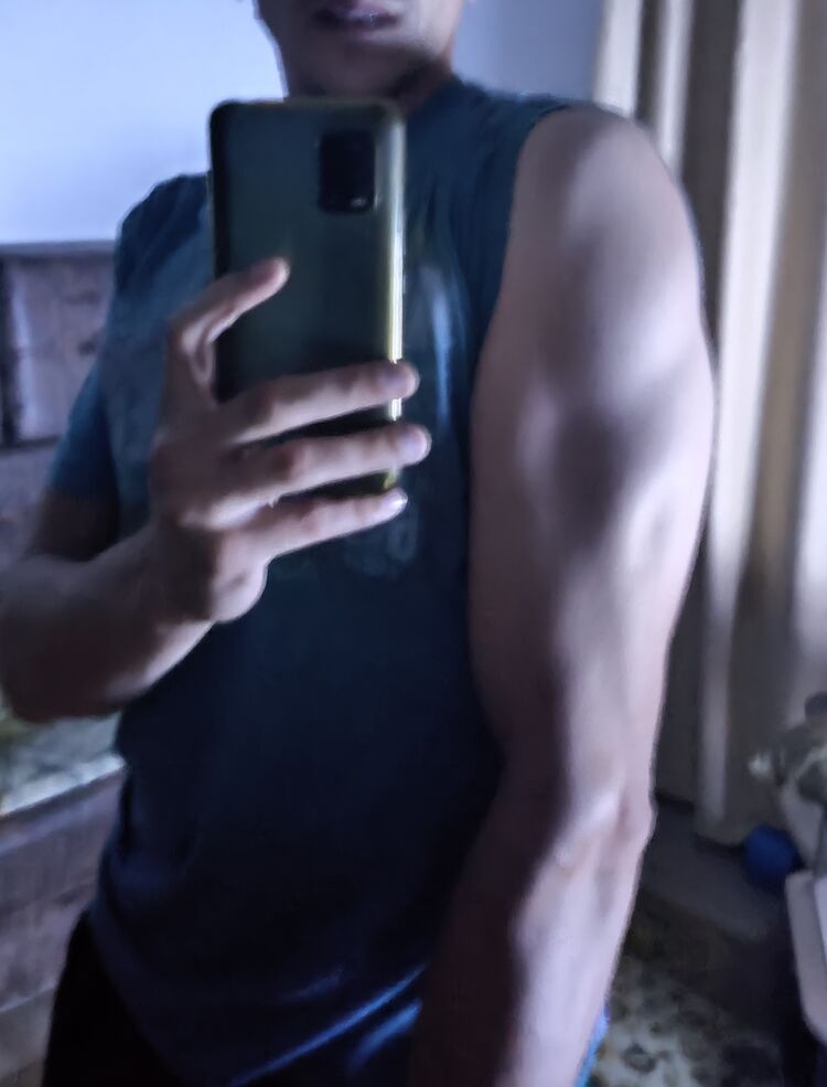  24661846  , 41 ,    