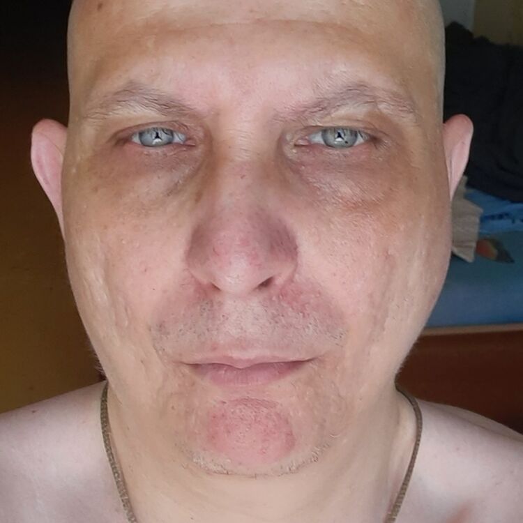  45419436  , 42 ,    