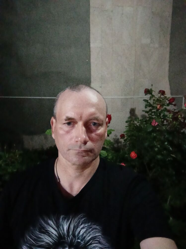  35266536  , 46 ,    