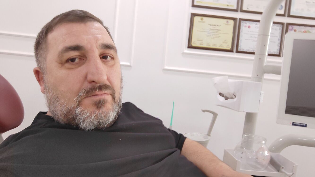  49108606  Samvel, 45 ,    