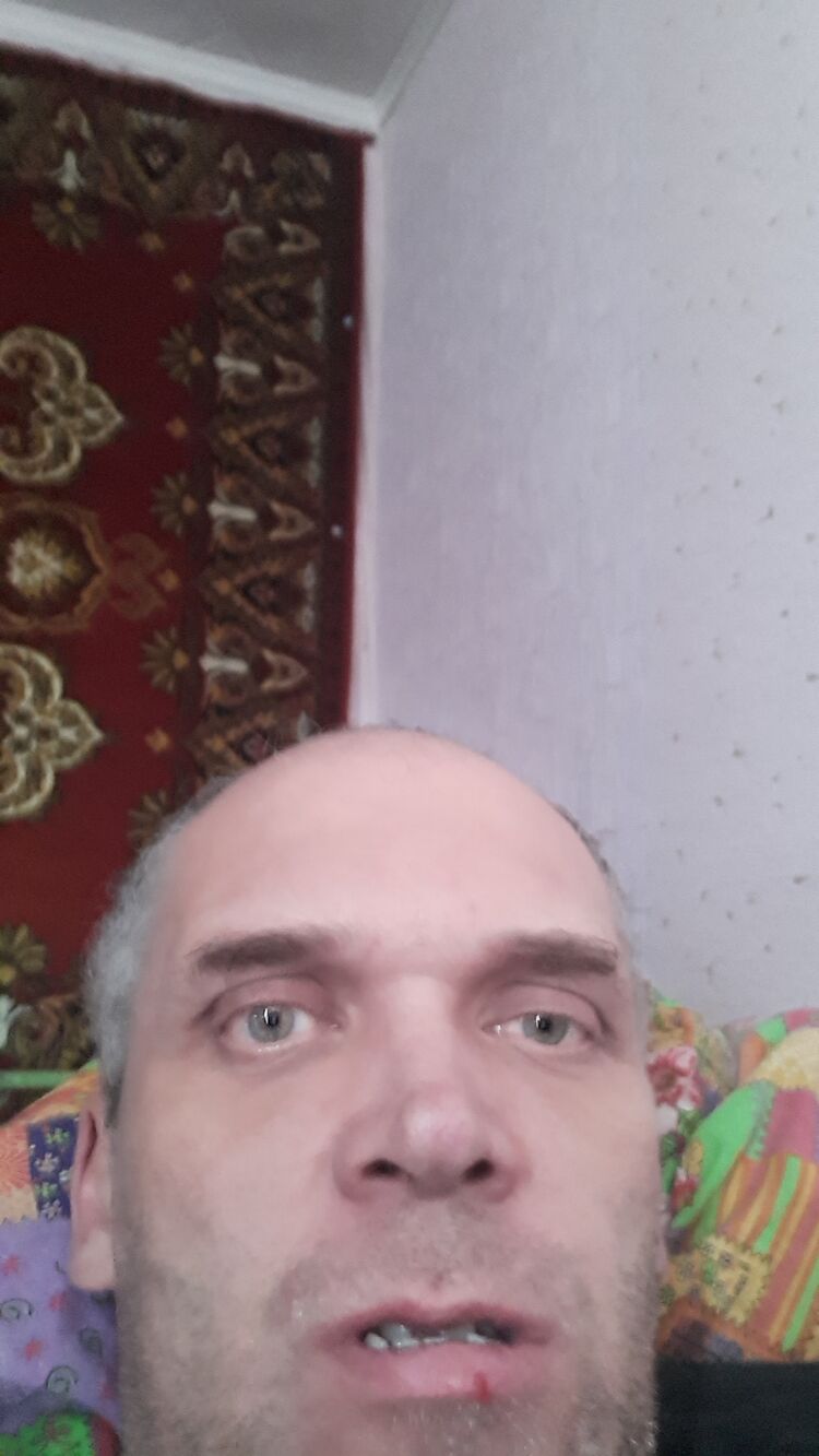  31139286  , 48 ,    