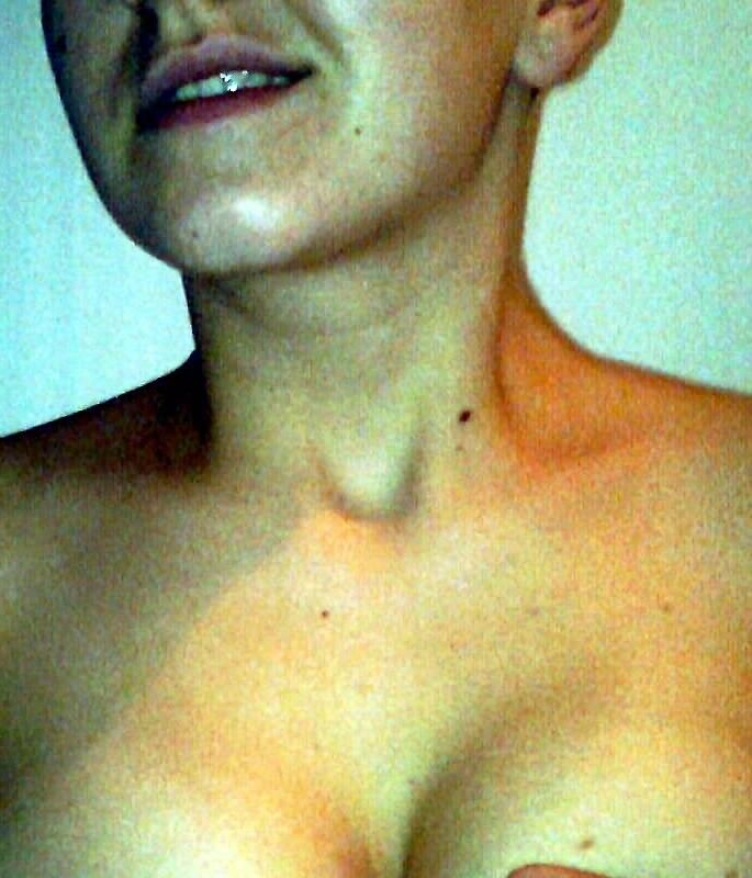 ���������� �����, ���� ������� �������, 35 ���, ������������ 