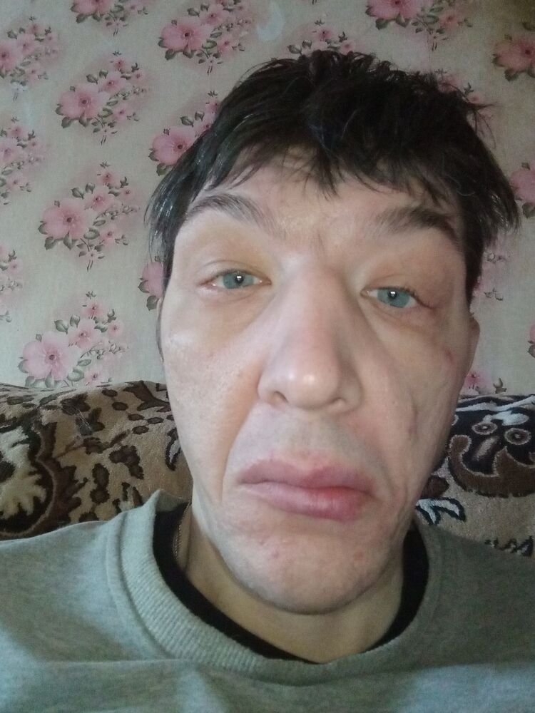  39751376  , 42 ,    