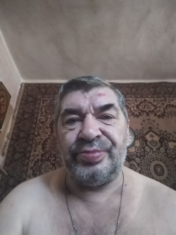  23652976  , 57 ,    