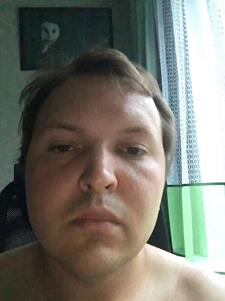  36783406  , 31 ,    