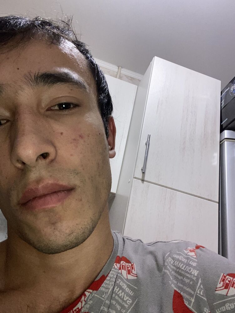  47687276  , 21 ,     