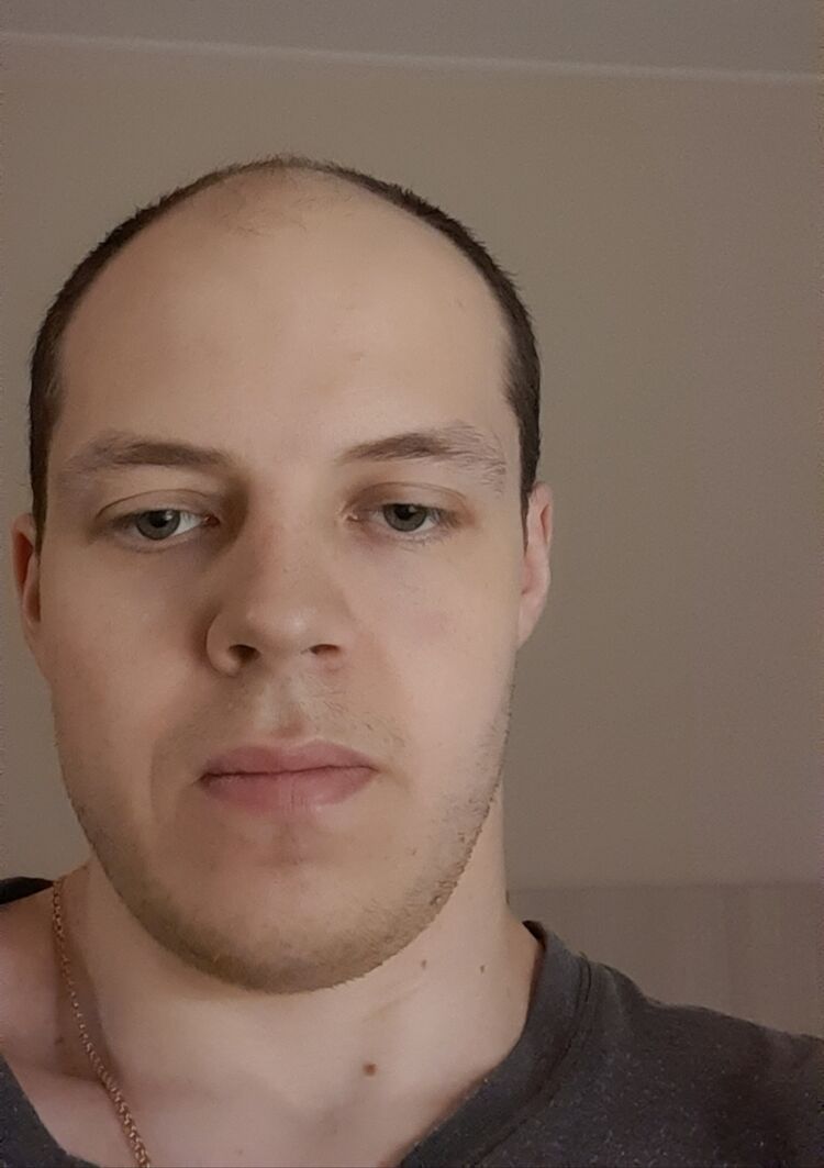  31842366  , 33 ,    