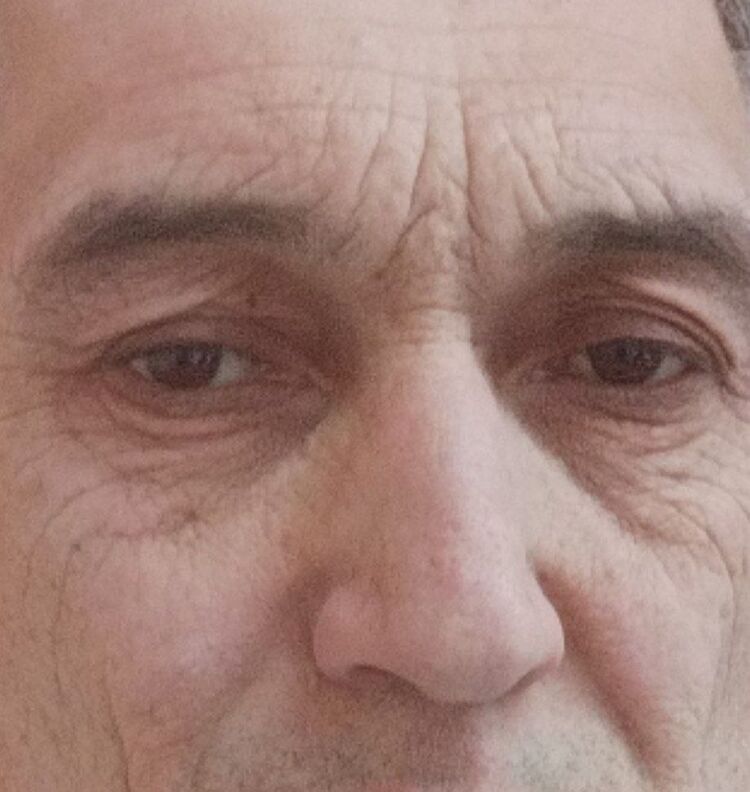  36325746  , 53 ,    