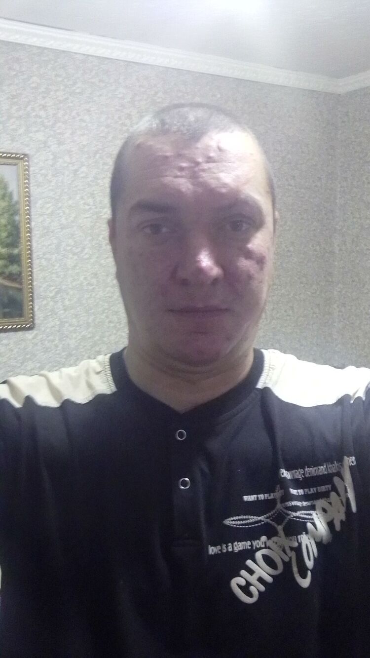  39830716  , 36 ,    