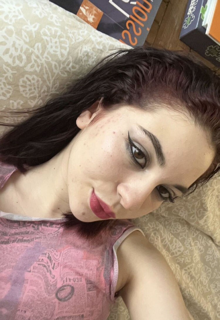  Rodez,   , 25 ,   ,   