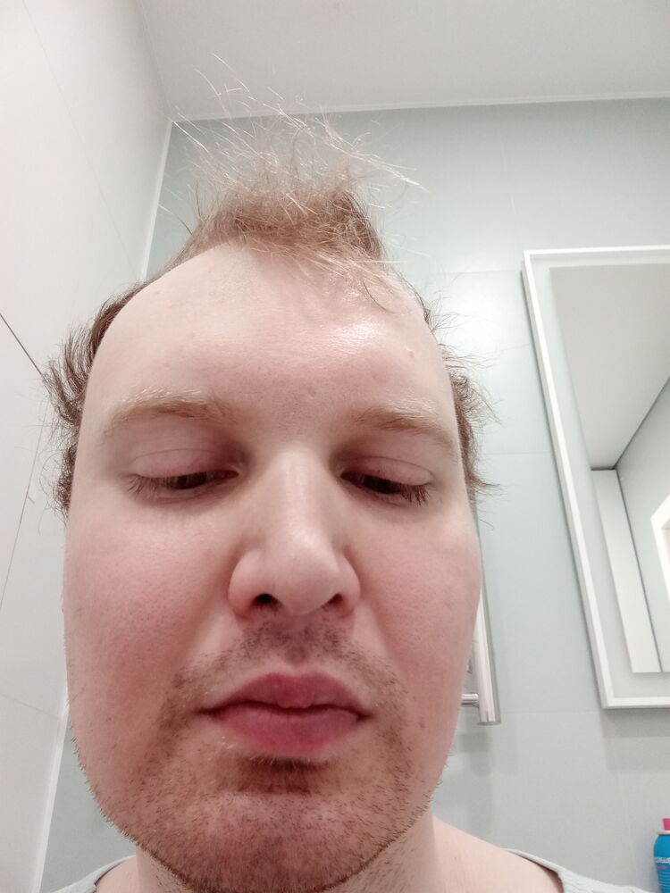  42232946  , 32 ,    
