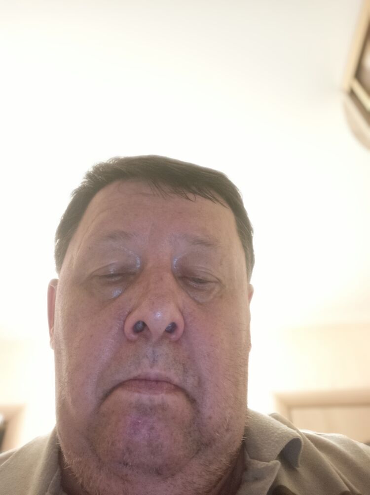  45226446  , 59 ,    
