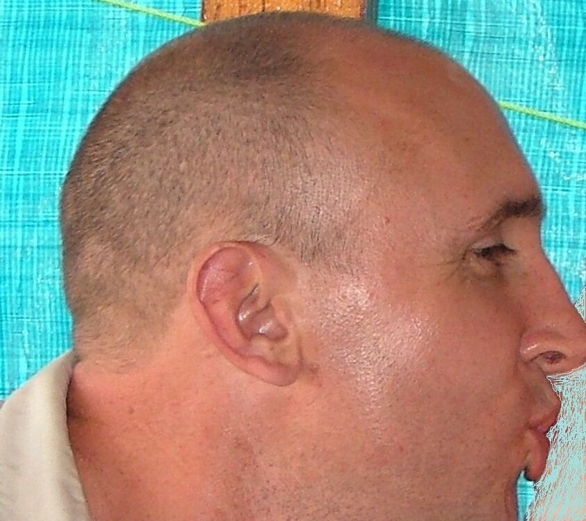  ,   ANDR  INALIN, 56 ,   ,   , c 