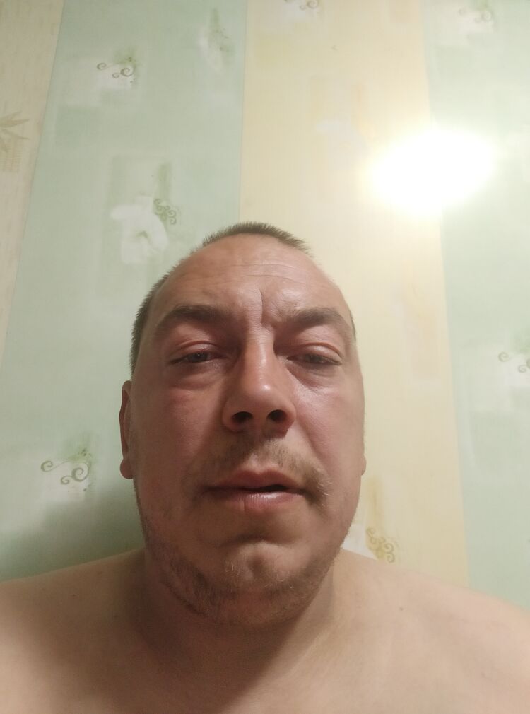  35382406  , 44 ,     