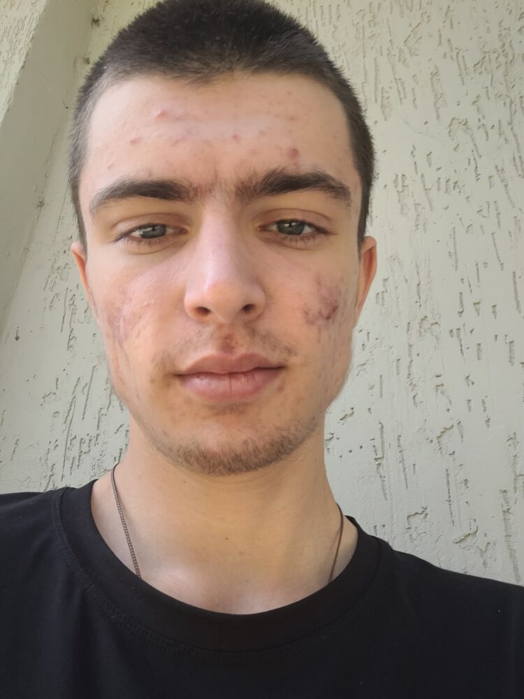  28030296  , 21 ,    