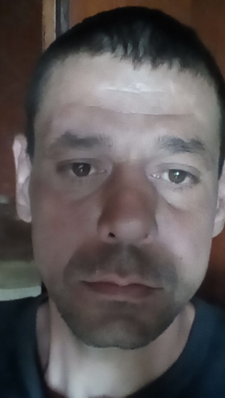  23176986  , 41 ,    
