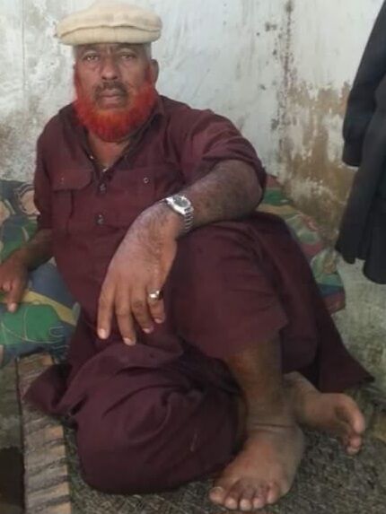 ���������� ����-���������, ���� ������� ��, 37 ���, ������������ ��� ������, ����� � ���������