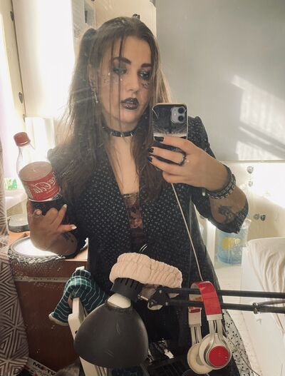  -,   Scarlatina, 34 ,   ,   , c , 