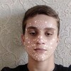   rxplqy